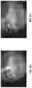 Fig. 09 - System and method of otoscopy image analysis to diagnose ear pathology
