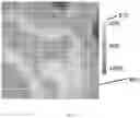 Fig. 08 - Tissue hemoglobin measuring instrument and tomographic reconstruction method for oxyhemoglobin/deoxyhemoglobin concentrations