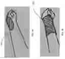 Fig. 28 - Biocompatible Material With Pain Management Capability And Method Of Use Thereof
