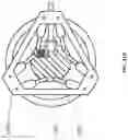 Fig. 49 - Biocompatible Material With Pain Management Capability And Method Of Use Thereof