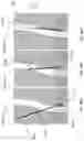 Fig. 77 - Biocompatible Material With Pain Management Capability And Method Of Use Thereof