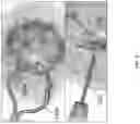 Fig. 03 - BIMANUAL NEUROENDOSCOPIC ROBOT