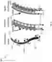 Fig. 07 - BIMANUAL NEUROENDOSCOPIC ROBOT