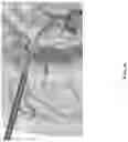 Fig. 28 - BIMANUAL NEUROENDOSCOPIC ROBOT