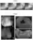 Fig. 06 - METHODS FOR PRODUCING RETINAL TISSUE AND RETINA-RELATED CELL
