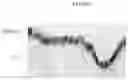 Fig. 09 - In vitro epithelial models comprising lamina propria-derived cells