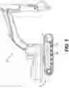 Fig. 02 - Flip-flop track idlers