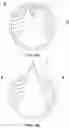 Fig. 05 - POUR SPOUT FOR A LIQUID CONTAINER