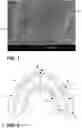Fig. 02 - CUSTOM-FORMABLE NIGHT GRINDING APPLIANCE AND METHOD OF USE