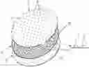 Fig. 01 - PROTECTIVE DRESSING FOR ABDOMINAL VISCERA IN NEGATIVE PRESSURE THERAPY
