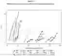Fig. 06 - Gene therapy for AADC deficiency