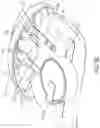 Fig. 09 - NASAL STIMULATION DEVICES AND METHODS FOR TREATING DRY EYE