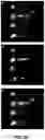 Fig. 28 - Lateral filter array microfluidic device
