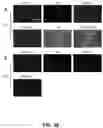 Fig. 40 - Lateral filter array microfluidic device