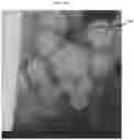 Fig. 02 - Environmentally biodegradable microcapsules