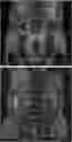Fig. 01 - Method of treating IgG4-related disease