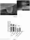Fig. 07 - Methods and devices for the generation of oocytes with improved oocyte quality for in vitro fertilization procedures using non-invasive cellular transfer