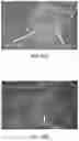 Fig. 09 - Methods and devices for the generation of oocytes with improved oocyte quality for in vitro fertilization procedures using non-invasive cellular transfer