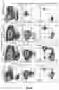 Fig. 09 - Pluripotent stem cell and T cell differentiated therefrom and application thereof