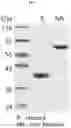 Fig. 02 - PHARMACEUTICAL COMPOSITION FOR PREVENTING OR TREATING CANCER, CONTAINING CD300C EXPRESSION INHIBITOR OR ACTIVITY INHIBITOR