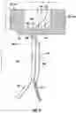 Fig. 07 - Engine inspection and maintenance tool
