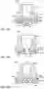 Fig. 12 - Fuel Injector Valve Seat Assembly Including an Insert that Forms a Valve Seat