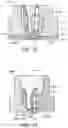 Fig. 16 - Fuel Injector Valve Seat Assembly Including an Insert that Forms a Valve Seat