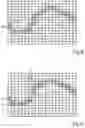 Fig. 11 - Computer-implemented method, computer program and diagnostic system, in particular for determining at least one geometric feature of a section of a blood vessel