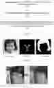 Fig. 02 - METHOD AND DEVICE FOR PROCESSING IMAGE, RELATED ELECTRONIC DEVICE AND STORAGE MEDIUM