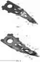 Fig. 02 - Suspension damping