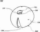 Fig. 01 - Ear tip with wedge-shaped apertures and earpiece with the same