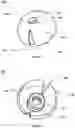 Fig. 02 - Ear tip with wedge-shaped apertures and earpiece with the same