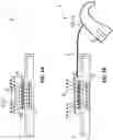 Fig. 02 - Charging and updating of an implantable hearing aid