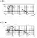Fig. 07 - Management server, audio testing method, audio client system, and audio testing system