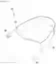 Fig. 02 - Head mounted display device for eye examination and method for ophthalmic examination using therefor