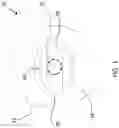 Fig. 02 - Wireless pressure-sensitive dressing assemblies and wireless monitoring systems equipped therewith