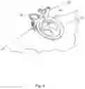 Fig. 06 - Scleral depression mechanical assist device