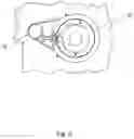 Fig. 07 - Scleral depression mechanical assist device