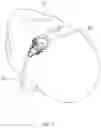 Fig. 08 - Scleral depression mechanical assist device