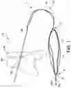 Fig. 02 - Partially assembled knotless suture construct