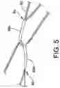 Fig. 06 - Partially assembled knotless suture construct