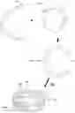 Fig. 01 - Magnetic anastomosis devices and methods of delivery