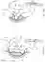 Fig. 145 - APPARATUS FOR CONTROLLING FLOW IN A BODILY ORGAN