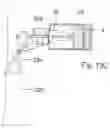 Fig. 16 - APPARATUS FOR CONTROLLING FLOW IN A BODILY ORGAN