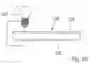 Fig. 29 - APPARATUS FOR CONTROLLING FLOW IN A BODILY ORGAN