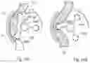 Fig. 33 - APPARATUS FOR CONTROLLING FLOW IN A BODILY ORGAN