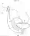 Fig. 41 - APPARATUS FOR CONTROLLING FLOW IN A BODILY ORGAN