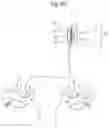 Fig. 46 - APPARATUS FOR CONTROLLING FLOW IN A BODILY ORGAN