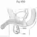 Fig. 60 - APPARATUS FOR CONTROLLING FLOW IN A BODILY ORGAN