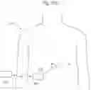 Fig. 72 - APPARATUS FOR CONTROLLING FLOW IN A BODILY ORGAN